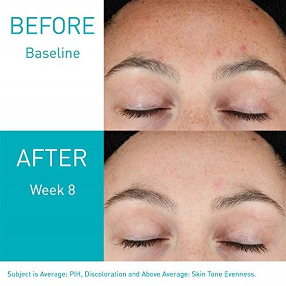 Cerave Resurfacing Retinol Serum: Smooth & Revitalize Your Skin