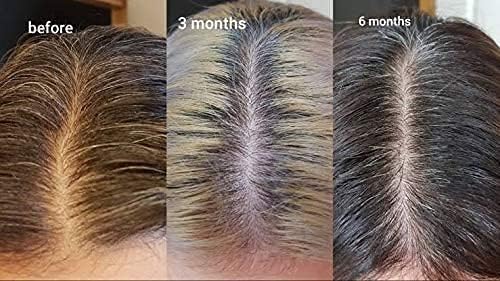 Multi Peptide Serum For Hair Density